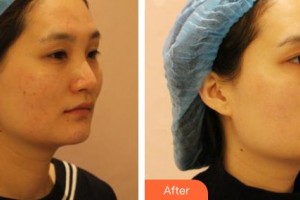 臨汾堯都恒信齒科診所盧國柱整形價(jià)格表附激光祛斑案例展示