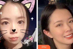 呼和浩特董志新口腔門(mén)診部金霞整形價(jià)格表附金屬托槽矯正案例展示