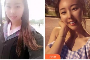 呼和浩特董志新口腔門(mén)診部張建明整形價(jià)格表附牙齒陶瓷矯正案例展示