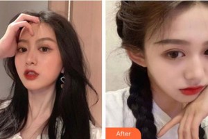 包頭麗人婦產(chǎn)醫(yī)院醫(yī)學(xué)美容科梁月月整形價格表附無針?biāo)獍咐故?>
</a>
<h3 class=