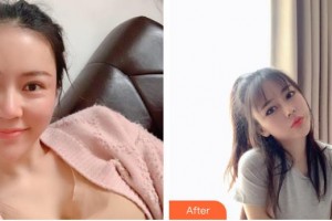 包頭聯(lián)合麗格醫(yī)療美容門(mén)診部賀清枝整形價(jià)格表附鼻部綜合案例展示