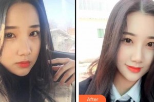 包頭貝特瑞爾口腔門診部劉金龍整形價格表附冷光美白案例展示