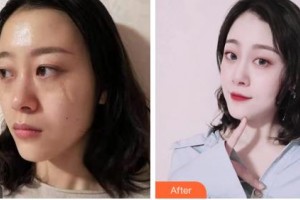 吉林省公安邊防總隊(duì)醫(yī)院醫(yī)整形美容中心王磊整形價(jià)格表附微創(chuàng)疤痕修復(fù)案例展示