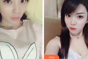 吉林銘醫(yī)整形美容醫(yī)院尤海濱整形價(jià)格表附白瓷娃娃案例展示