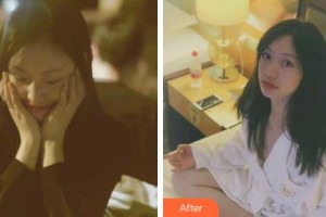 吉林省公安邊防總隊(duì)醫(yī)院醫(yī)整形美容中心李萬(wàn)同整形價(jià)格表附激光祛斑案例展示