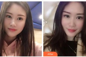 吉林星范醫(yī)療美容門(mén)診部楊雯淇整形價(jià)格表附冷光美白案例展示