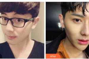 吉林吳麗娟醫(yī)療美容診所吳麗娟整形價(jià)格表附眼部綜合案例展示