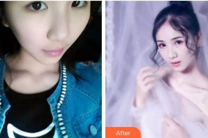 長(zhǎng)春愛(ài)麗醫(yī)療美容門(mén)診部華淑麗整形價(jià)格表附眼部綜合案例展示