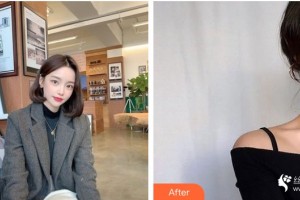 咸陽華爾醫(yī)療美容門診部王虹力整形價格表附皮膚美容案例展示