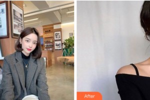 寧夏華美整形美容醫(yī)院易多奇整形價格表附皮膚美容案例展示