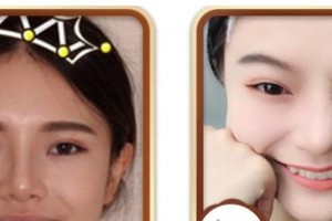 寶雞市口腔醫(yī)院毛瑩瑩整形價格表附冷光美白案例展示