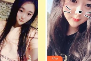 寶雞市口腔醫(yī)院丁群整形價(jià)格表附美白劑美白牙齒案例展示