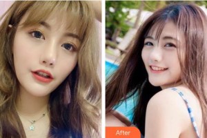 貴州歐貝頤醫(yī)療整形醫(yī)院宋輝整形價(jià)格表附激光祛斑案例展示