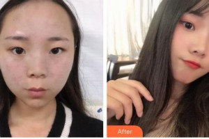 遵義韓美整形美容醫(yī)院聶波整形價格表附激光祛斑案例展示