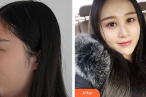 銅仁韓美時光醫(yī)療美容門診部張葉軍整形價格表附眼部綜合案例展示