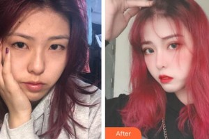 銅仁仁愛眼科醫(yī)院張曉承整形價格表附眼部綜合案例展示