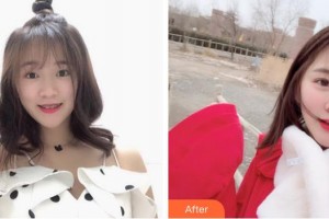 畢節(jié)西南皮膚病醫(yī)院陳超整形價格表附切開雙眼皮案例展示