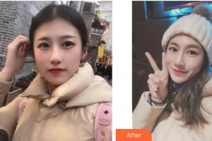 武警廣西總隊醫(yī)院醫(yī)學(xué)整形美容中心夏天整形價格表附美白導(dǎo)入案例展示