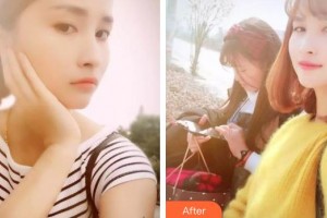 廣西中醫(yī)藥大學(xué)附屬瑞康醫(yī)院整形美容中心高靜整形價格表附美白劑美白牙齒案例展示