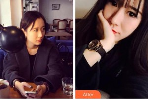 柳州愛爾眼科醫(yī)院陳光勝整形價(jià)格表附定點(diǎn)雙眼皮案例展示