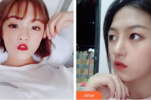 北海美秀中禾醫(yī)療美容診所謝詩涓整形價格表附眼部綜合案例展示