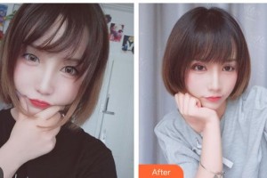 玉林愛爾眼科醫(yī)院劉偉民整形價格表附切開雙眼皮案例展示