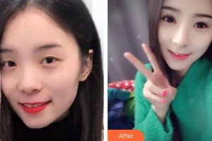 海南省中醫(yī)院眼科中心趙仲平整形價格表附眼部綜合案例展示