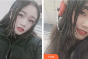 ?？诤佳谰S信口腔門(mén)診部方略宇整形價(jià)格表附牙齒隱形矯正案例展示