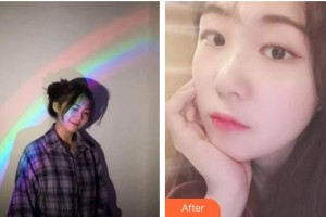 ?？诤佳谰S信口腔門(mén)診部曾婷整形價(jià)格表附超聲波潔牙案例展示