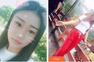 ?？谕？谇婚T(mén)診部陳新整形價(jià)格表附美白貼片案例展示