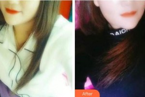 海口馬華祥口腔門(mén)診部馬華祥整形價(jià)格表附牙齒隱形矯正案例展示