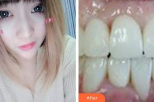 ?？诘露骺谇婚T(mén)診部喬磊整形價(jià)格表附超聲波潔牙案例展示