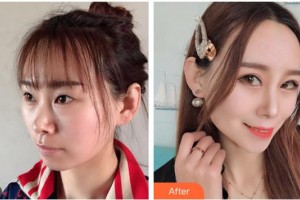 ?？诩t妝尚醫(yī)療美容門(mén)診部吳健整形價(jià)格表附眼部綜合案例展示