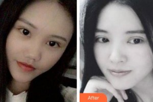 ?？诩t妝尚醫(yī)療美容門(mén)診部趙麗萍整形價(jià)格表附眼部綜合案例展示