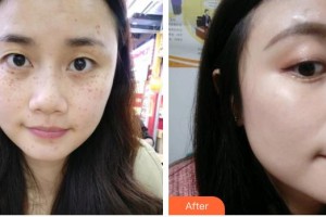 ?？诩t妝尚醫(yī)療美容門(mén)診部姚志文整形價(jià)格表附激光美膚激光案例展示