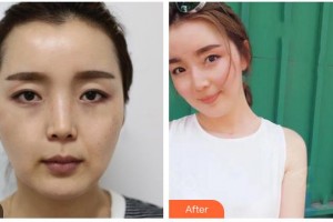 ?？诩t妝尚醫(yī)療美容門(mén)診部郭理霖整形價(jià)格表附熱拉提案例展示