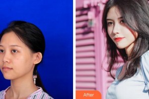 襄陽(yáng)維多利亞醫(yī)療美容醫(yī)院安邰晥整形價(jià)格表附鼻部綜合案例展示