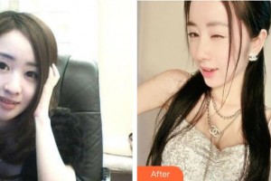 襄陽(yáng)韓素整形美容門診部周創(chuàng)業(yè)整形價(jià)格表附鼻部綜合案例展示