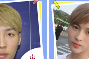 襄陽伊爾美整形美容醫(yī)院劉妮娜整形價格表附自體脂肪墊下巴案例展示