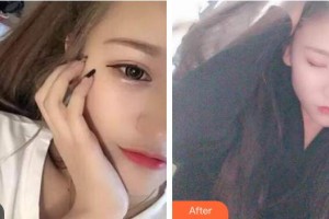 襄陽時代口腔醫(yī)院耿亞坤整形價格表附冷光美白案例展示