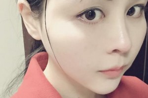 贛州華美醫(yī)療美容門診部黃明光整形價(jià)格表附埋線提升例展示