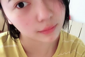 贛州立勤口腔門診部劉飛整形價格表附牙齒矯正案例展示