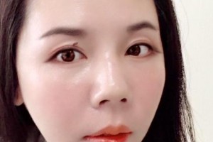 贛州維樂口腔門診部葉飛整形價格表附牙齒矯正案例展示