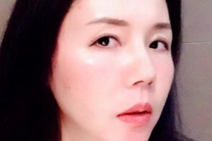 吉安康明眼科醫(yī)院張運江整形價格表附眼部綜合案例展示