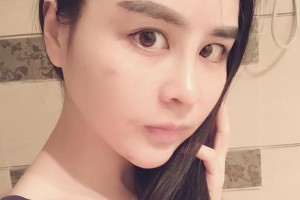 吉安保仕柏麗醫(yī)療美容門診部周軍整形價格表附口腔綜合案例展示