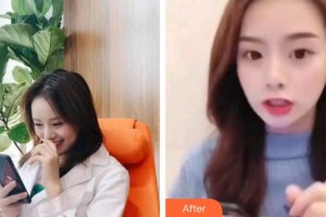 宜春學(xué)院整形美容醫(yī)院王小麗整形價格表附超聲波潔牙案例展示