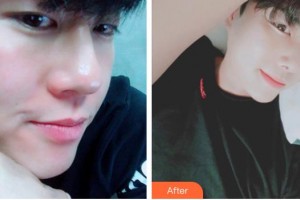 宜春愛爾眼科醫(yī)院蘭麗霞整形價(jià)格表附眼部綜合案例展示