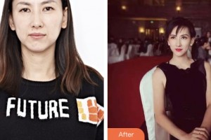 荊門市第一人民醫(yī)院醫(yī)學(xué)美容中心李薇薇整形價格表附超聲提拉案例展示