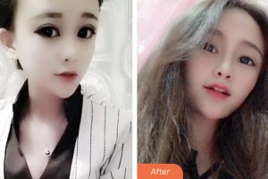 荊門亞貝特口腔醫(yī)院趙高峰整形價格表附美白劑美白牙齒案例展示