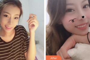 荊門小白兔口腔醫(yī)院王軍新整形價(jià)格表附牙齒隱形矯正案例展示